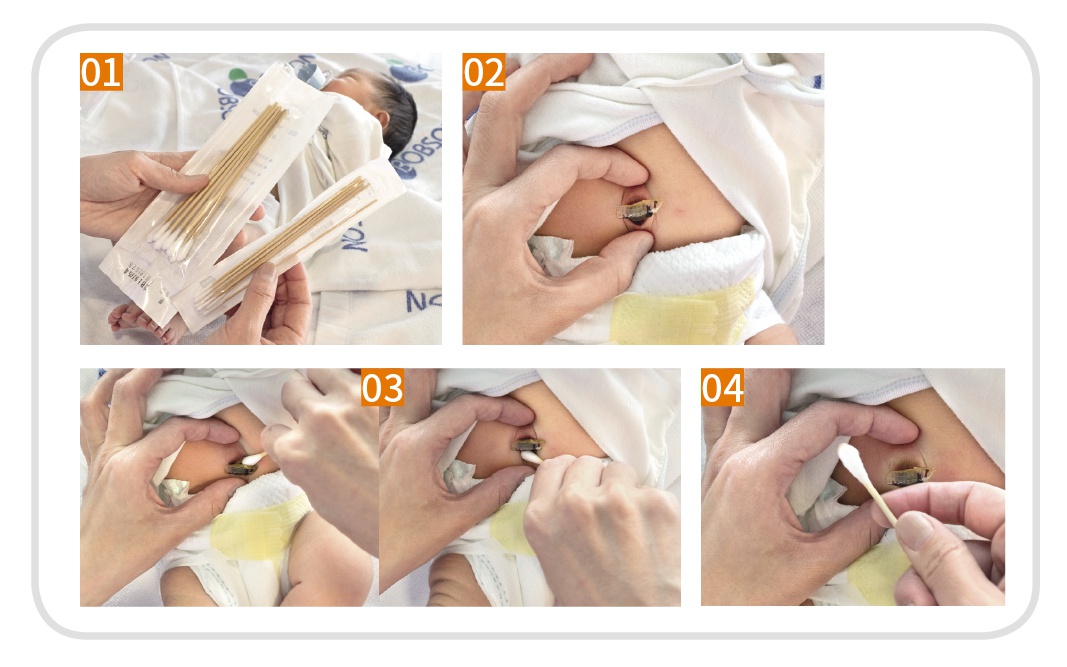 勤换尿布避免尿红臀,脐带护理养出漂亮肚脐眼 新生儿护理全教学