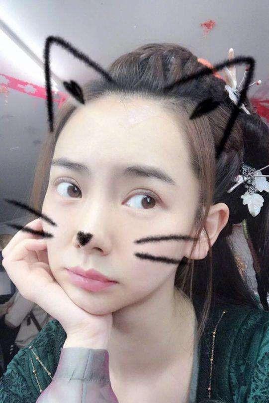 戚薇双眼皮二次修复,故意不化妆见观众,整容医生被喷:你手抖吗