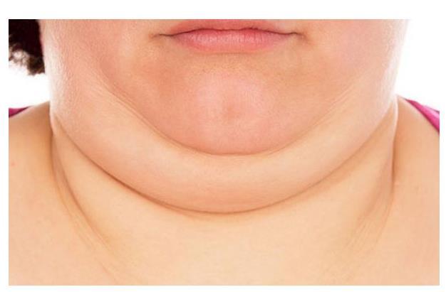 脖子越粗寿命就越短颈围多少最健康看看你有没有达标