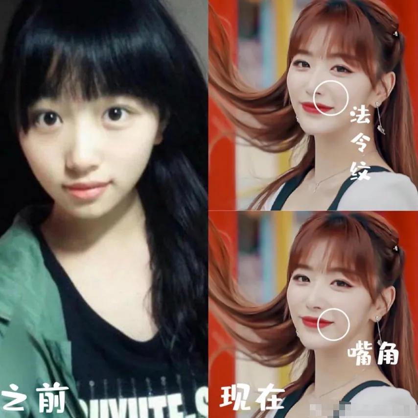 孔雪儿旧照曝光,和如今长相对比变了一张脸,粉丝都没能认出来!