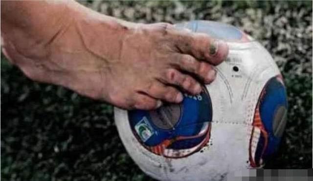 看看梅西c罗的脚,詹姆斯的眼睛,还羡慕体育巨星的高薪吗?