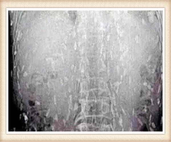 女子长期吃生鱼片肚子疼痛难忍, 医生给她检查身体后当场愣住了休闲区蓝鸢梦想 - Www.slyday.coM