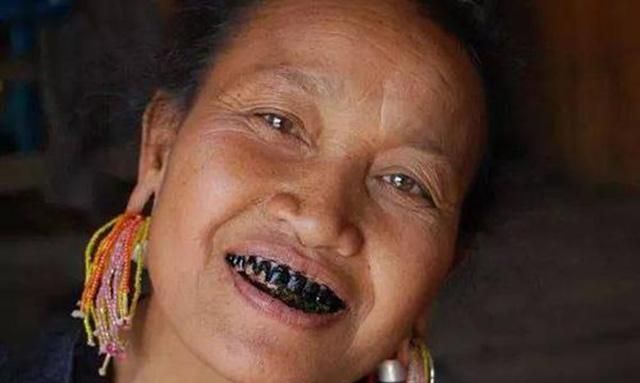 古代日本贵族为何会喜欢用铁浆染黑牙齿