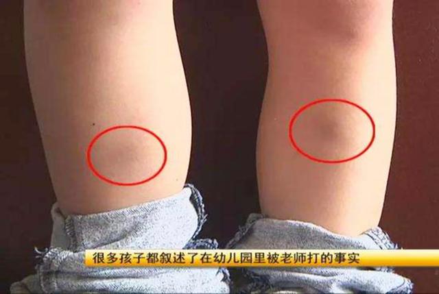 "110接我,120接你",暴怒父亲不顾阻拦,誓和老师"碰一碰"