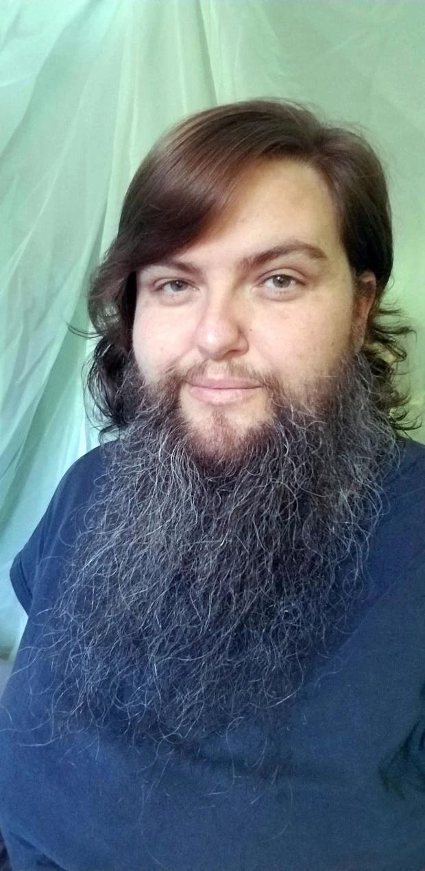 美13岁少女疯狂长胡子,35年后终接纳自己参加胡子大赛得第6名