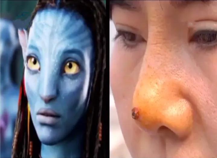 被儿子调侃鼻子像猪八戒女子整容后变阿凡达