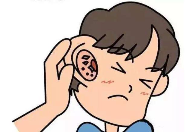 耳朵总是发痒但又掏不出来东西可能是疾病的信号别忽视
