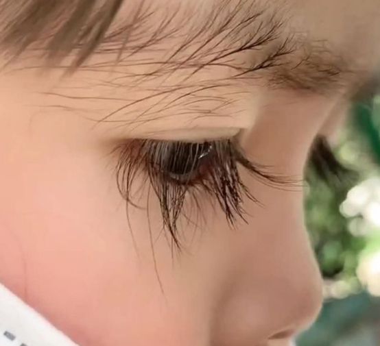 睫毛太短的话首先首先不美观,不能有效的阻挡灰尘,会对眼睛造成一定的