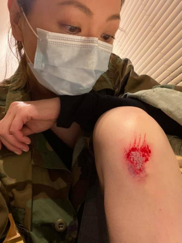 tvb实力视后正式宣布约满:自嘲要重新学走路