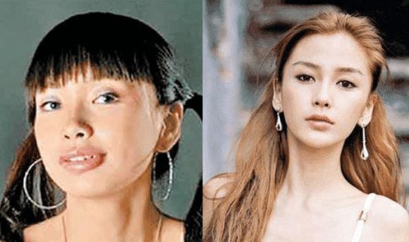 有一种整容叫傅园慧整牙后美到认不出
