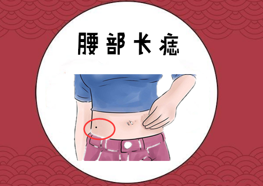 "好运痣",5颗吉祥痣,招财带福气,婚姻美满,事业一帆风顺!