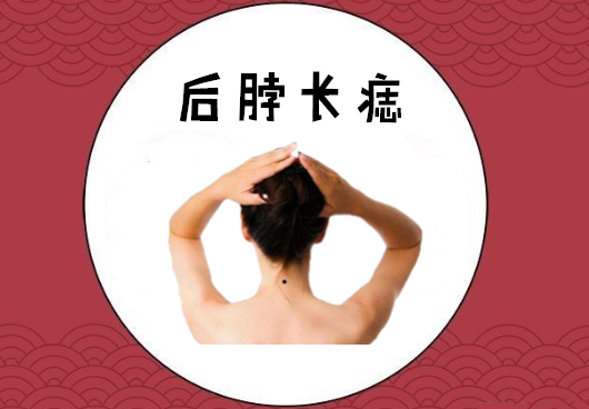 "好运痣",5颗吉祥痣,招财带福气,婚姻美满,事业一帆风顺!