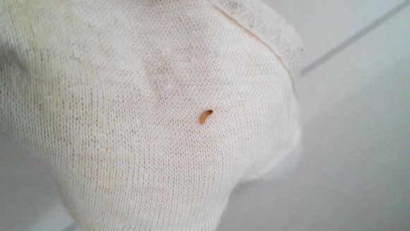 女子洗贴身衣服爬出白虫放锅里煮结果让她面色苍白