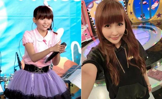 37岁蝴蝶姐姐近照大变脸?双唇嘟嘟疑似丰唇太过,网友:好像鸭子