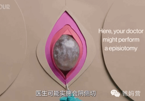 谢娜双胞胎生产全过程曝光,脐带绕颈,脊椎麻药,这种痛