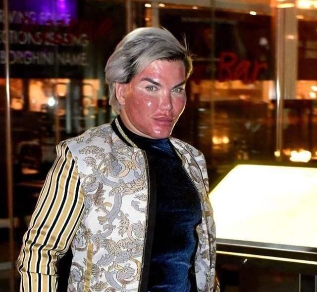 奇葩男网红整容72次!为变"美"动刀无底线__财经头条