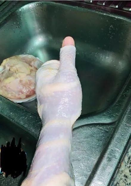 关于儿童发票起鸡皮疙瘩怎么办的信息