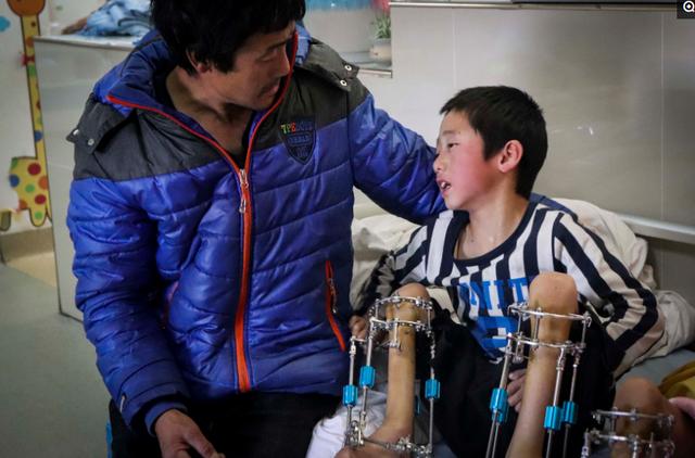 孕妈生出个残疾儿子,竟又冒险生二胎,孩子出生后父母愧疚不已