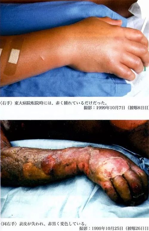 那么,心肌上的细胞为什么没有受到放射性的伤害呢?