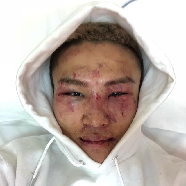 中国嘴炮李凯文:格斗排名对我没影响,目标仍然是世界冠军