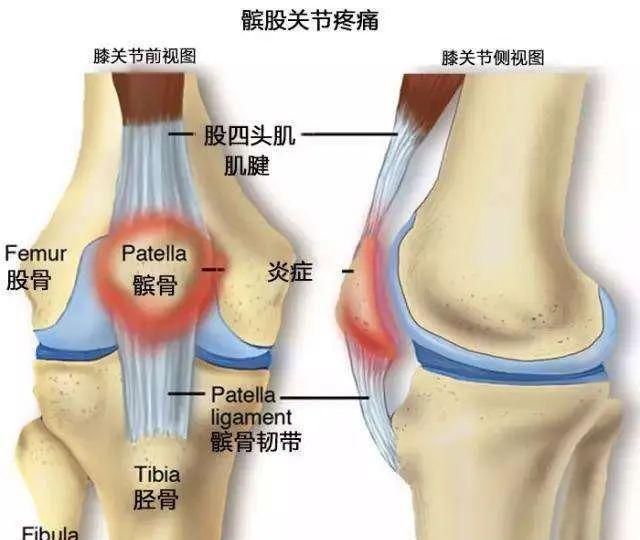 5個動作避免毀膝蓋|肌肉|膝關節|訓練_新浪新聞