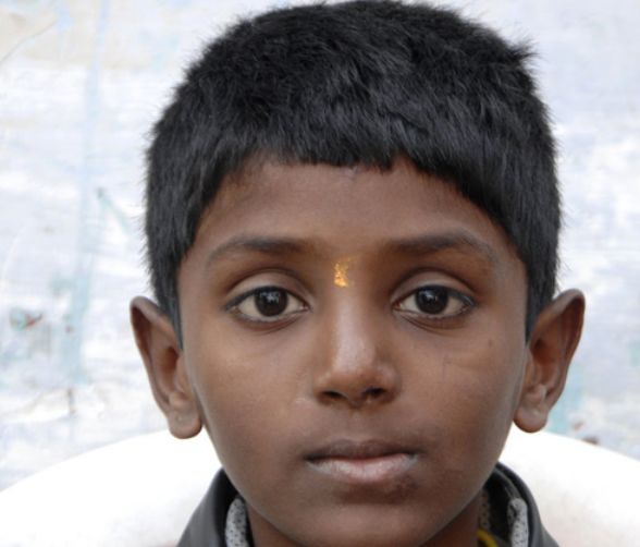 印度牙齿最多的男孩,嘴里长526颗牙齿,网友:那他要怎么吃东西