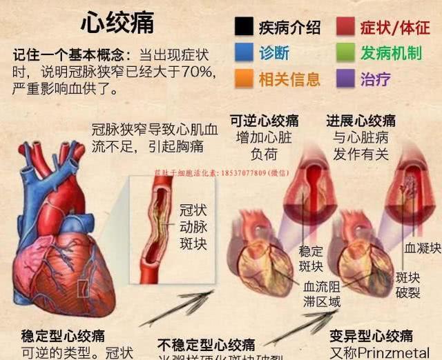 都是胸痛心绞痛和心梗有什么区别心梗是要命的必须马上住院