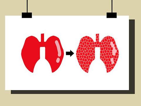咳嗽时,咳出黄痰、白痰、红痰、绿痰,暗示哪些问题?|新冠肺炎_新浪新闻