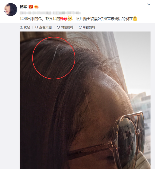 秦岚表示难以接受,她俩实在让人心疼|白头发|秦岚|白发_新浪网