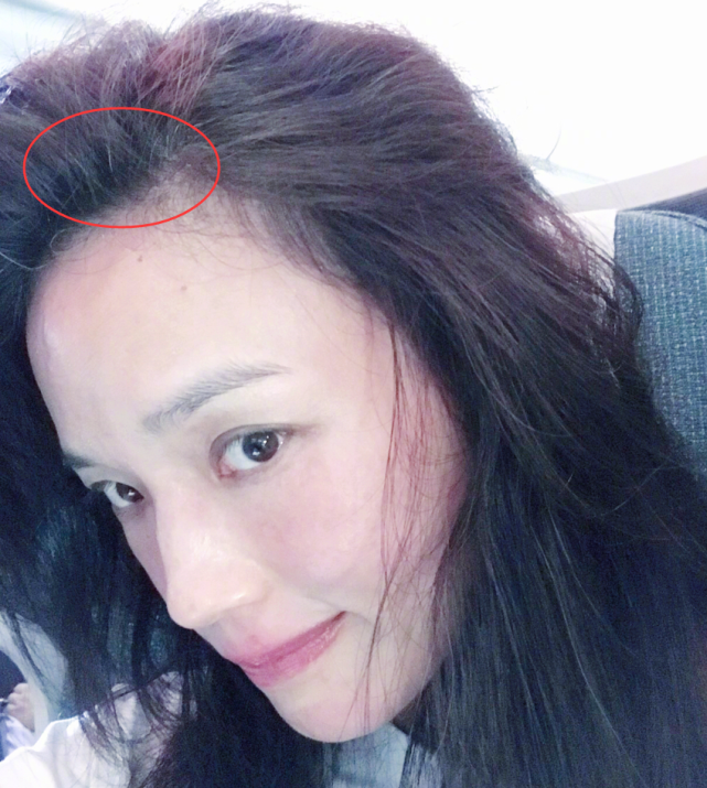 年纪轻轻长白发的美女明星:秦岚表示难以接受,她俩实在让人心疼