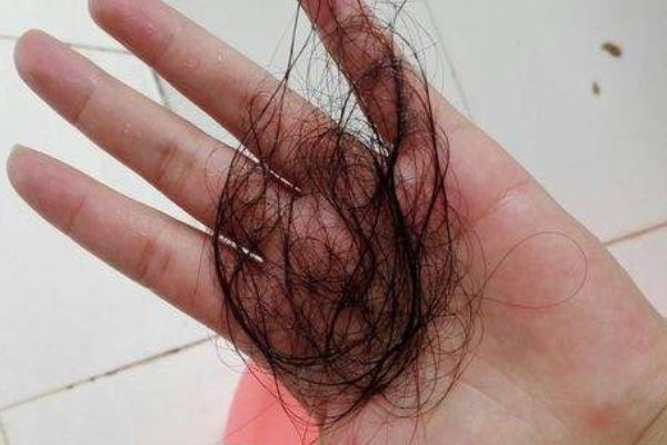 经常掉头发怎么办?教你一个农村"土方法",让头发越来越浓密!