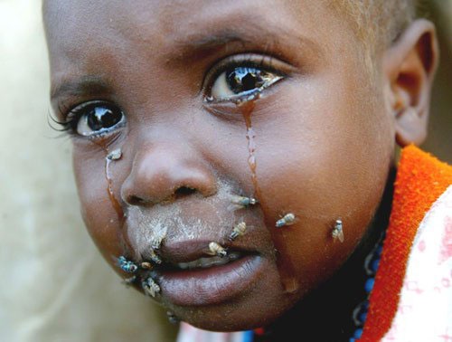 你是在度假还是在旅行?看着那些小孩满身都是苍蝇,你作何感想?