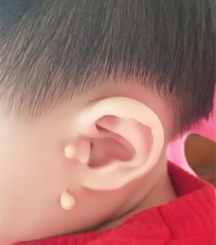 小女孩长"附耳",理发时被邻居嘲笑,网友:外界的恶意也太大了