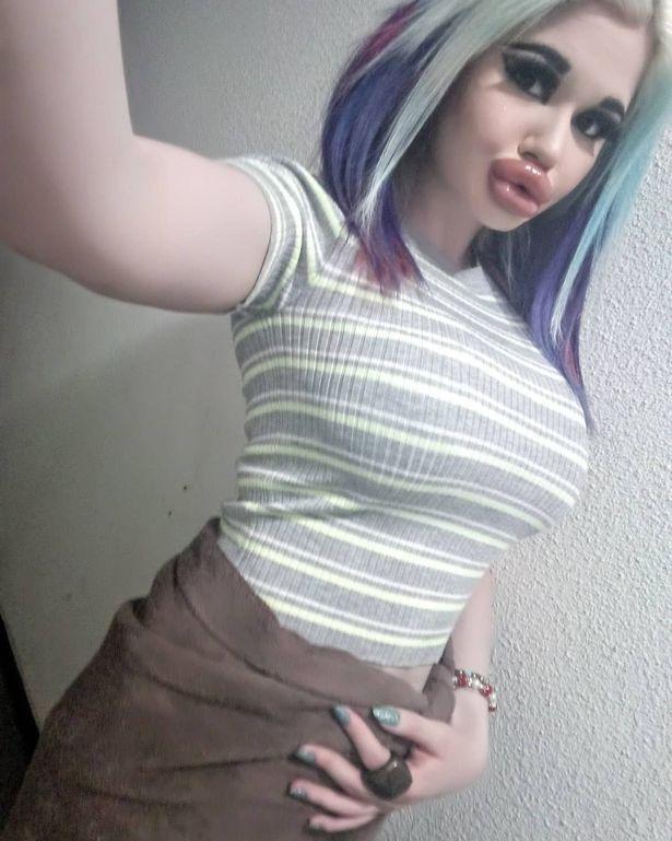 保加利亚美女丰唇20次,自称拥有世界上最大的嘴唇