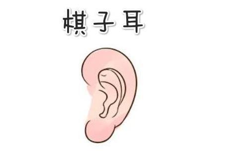 棋子耳在相学中,所谓的棋子耳,就是指,耳朵生得圆小而坚实也没有明显