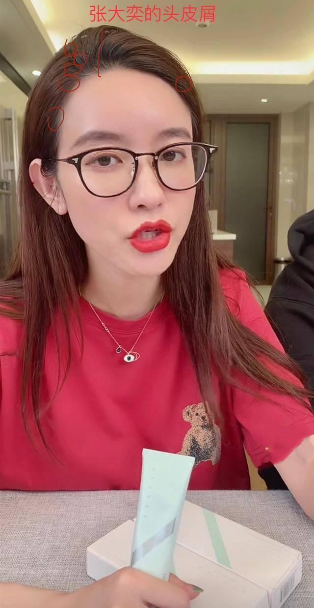 张大奕近况:直播卖货求放过,头皮屑掉落像油腻大妈