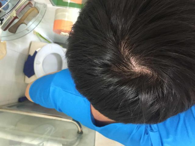 头顶双旋的孩子比单旋的孩子更活泼聪明其实很多父母都误解了