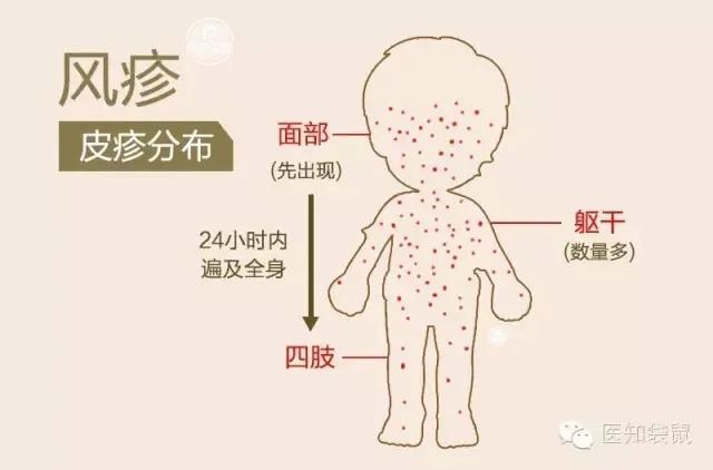 猩红热高发期家有210岁儿童的家长一定要注意