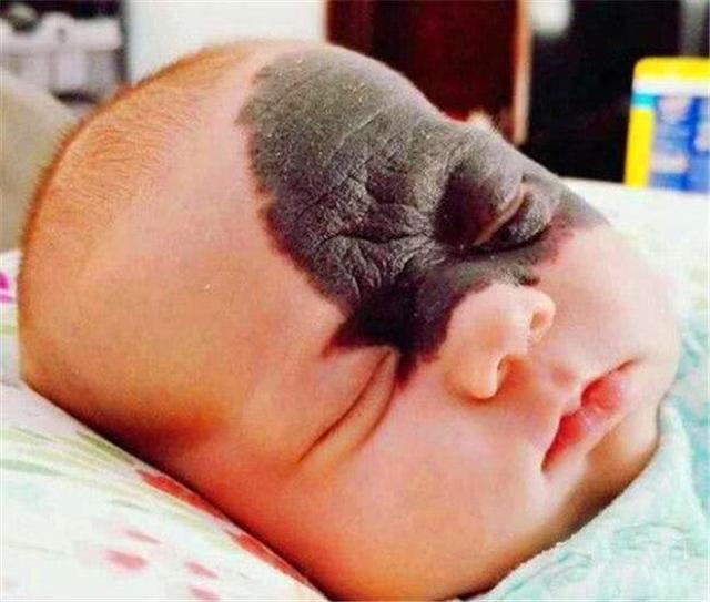 被誉为"最美胎记"的龙凤胎,兄妹未相见,却记着彼此