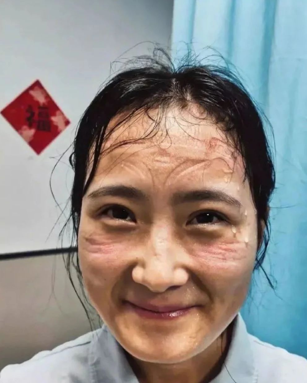 医护人员脸上写满疲惫,满是汗水压痕,却依然露出明媚笑容.