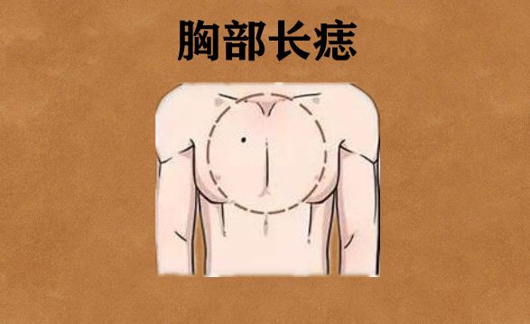 若是一个人的胸部的位置长有吉痣,则这样的人,天生富贵命,又有"胸怀