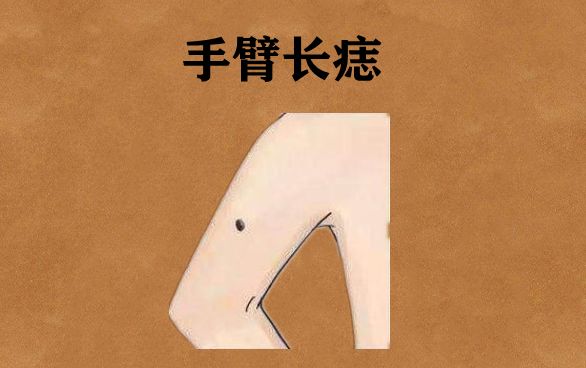 进财痣,身体此处长吉痣,正财稳定,横财暴涨,钱财哗哗来!