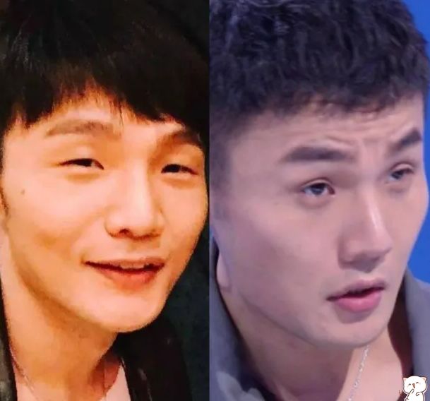 小眼睛李荣浩变双眼皮是啥样?看到最后效果,演反派都不用化妆了