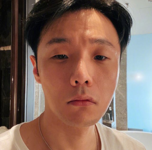 小眼睛李荣浩变双眼皮是啥样?看到最后效果,演反派都不用化妆了