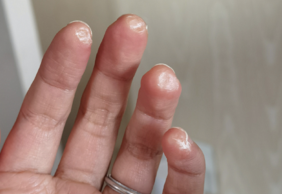 乘风破浪姐姐们有多拼万茜被指不敬业后晒出满手是茧照片