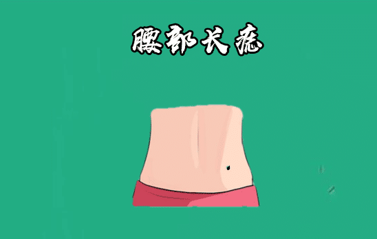 腰部长痣在相学当中,大多数在腰部的位置长有吉痣,多半会有"腰缠万贯"