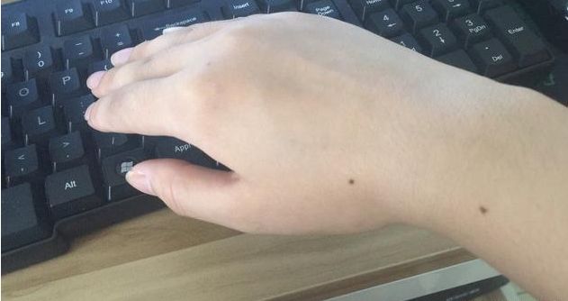 手背有痣的女人 手背有痣的女人图解