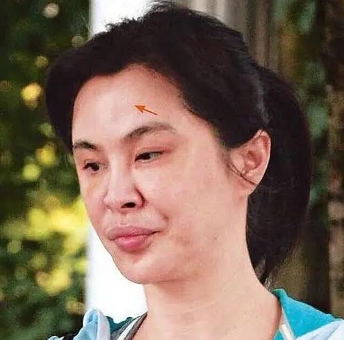 很多网友都说王祖贤的脸部变化特别大,一点都不像正常老去的样子,其实
