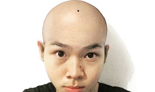 头顶长痣痣长在头顶中心的人,则是一个难得的富贵相,这样的人十分的