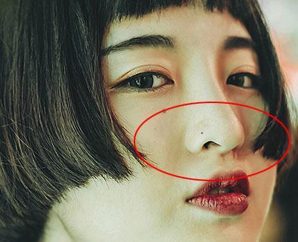 鼻子这三个地方长痣漏财败家命最苦一定要除